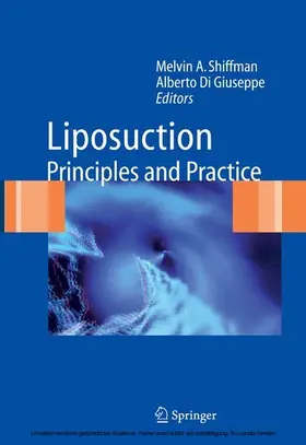 Shiffman / Di Giuseppe / Giuseppe |  Liposuction | eBook | Sack Fachmedien