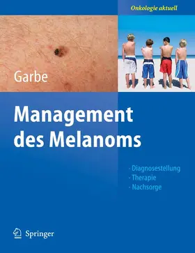 Garbe |  Management des Melanoms | eBook | Sack Fachmedien