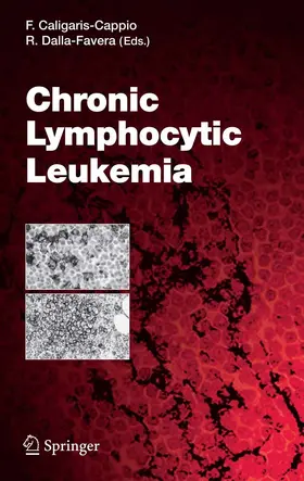 Caligaris-Cappio | Chronic Lymphocytic Leukemia | E-Book | www.sack.de