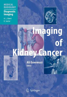 Guermazi | Imaging of Kidney Cancer | E-Book | sack.de