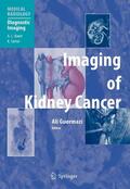 Guermazi |  Imaging of Kidney Cancer | eBook | Sack Fachmedien