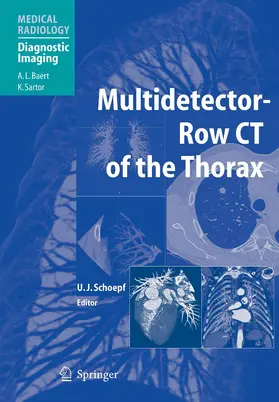 Schoepf |  Multidetector-Row CT of the Thorax | eBook | Sack Fachmedien