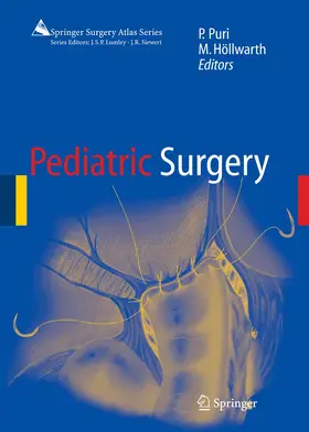 Puri / Höllwarth |  Pediatric Surgery | eBook | Sack Fachmedien