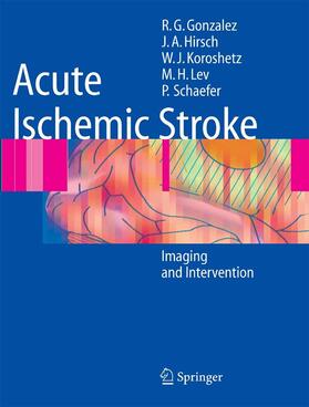 González / Hirsch / Lev | Acute Ischemic Stroke | E-Book | sack.de