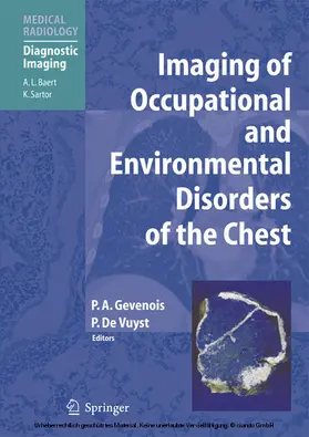 Gevenois / de Vuyst |  Imaging of Occupational and Environmental Disorders of the Chest | eBook | Sack Fachmedien