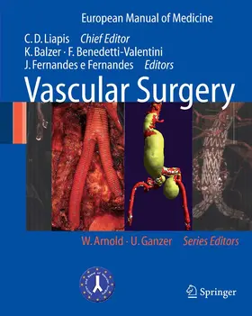 Liapis / Balzer / Benedetti-Valentini |  Vascular Surgery | eBook | Sack Fachmedien