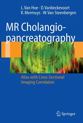 van Hoe / Vanbeckevoort / Mermuys |  MR Cholangiopancreatography | eBook | Sack Fachmedien