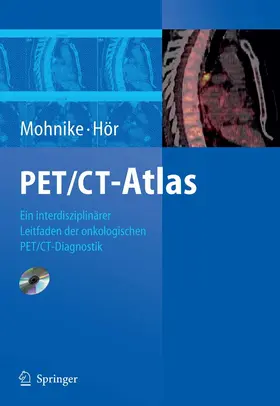 Mohnike / Hör / Schelbert |  PET/CT-Atlas | eBook | Sack Fachmedien