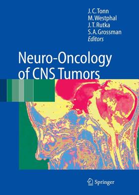 Tonn / Westphal / Rutka | Neuro-Oncology of CNS Tumors | E-Book | sack.de
