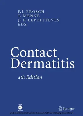 Frosch / Menne / Lepoittevin |  Contact Dermatitis | eBook | Sack Fachmedien
