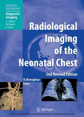 Donoghue |  Radiological Imaging of the Neonatal Chest | eBook | Sack Fachmedien
