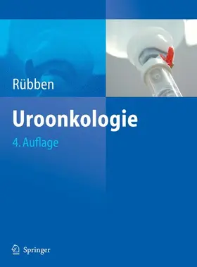 Rübben |  Uroonkologie | eBook | Sack Fachmedien