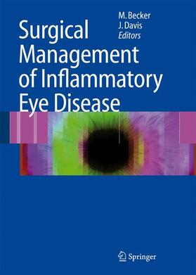 Davis / Becker | Surgical Management of Inflammatory Eye Disease | Buch | 978-3-540-33861-1 | sack.de