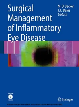 Becker / Davis |  Surgical Management of Inflammatory Eye Disease | eBook | Sack Fachmedien