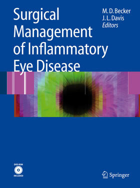 Becker / Davis | Surgical Management of Inflammatory Eye Disease | E-Book | sack.de