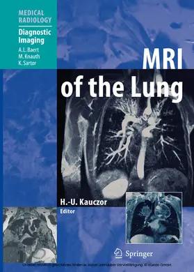 Kauczor |  MRI of the Lung | eBook | Sack Fachmedien