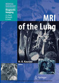 Kauczor |  MRI of the Lung | eBook | Sack Fachmedien