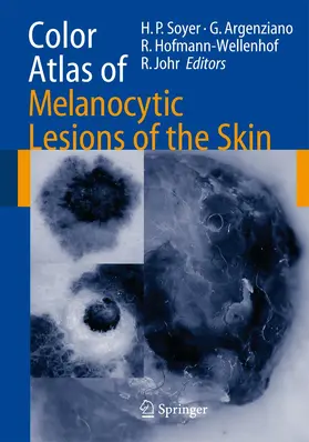 Soyer / argenziano / Hofmann-Wellenhof |  Color Atlas of Melanocytic Lesions of the Skin | Buch |  Sack Fachmedien