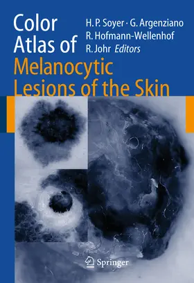 Soyer / Argenziano / Hofmann-Wellenhof |  Color Atlas of Melanocytic Lesions of the Skin | eBook | Sack Fachmedien