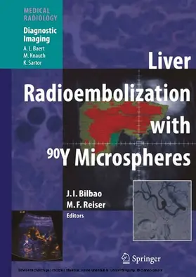 Bilbao / Reiser |  Liver Radioembolization with 90Y Microspheres | eBook | Sack Fachmedien