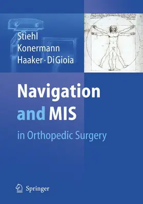 Stiehl / Konermann / Haaker |  Navigation and MIS in Orthopedic Surgery | Buch |  Sack Fachmedien