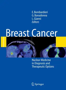 Bombardieri / Bonadonna / Gianni |  Breast Cancer | eBook | Sack Fachmedien
