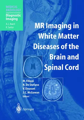 Filippi / de Stefano / Dousset |  MR Imaging in White Matter Diseases of the Brain and Spinal Cord | Buch |  Sack Fachmedien