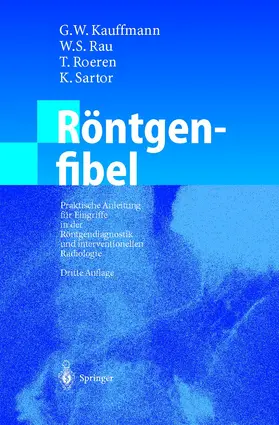Kauffmann / Rau / Roeren |  Röntgenfibel | Buch |  Sack Fachmedien