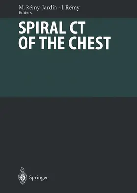 Remy-Jardin / Remy |  Spiral CT of the Chest | Buch |  Sack Fachmedien