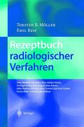 Reif / Möller |  Rezeptbuch radiologischer Verfahren | Buch |  Sack Fachmedien