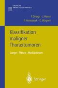 Drings / Wagner / Hasse |  Klassifikation maligner Thoraxtumoren | Buch |  Sack Fachmedien