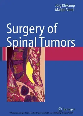Klekamp / Samii | Surgery of Spinal Tumors | E-Book | www.sack.de