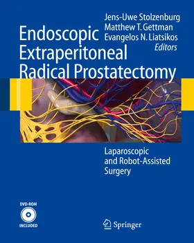 Stolzenburg / Gettman / Liatsikos |  Endoscopic Extraperitoneal Radical Prostatectomy | eBook | Sack Fachmedien