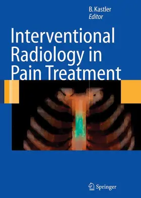Kastler | Interventional Radiology in Pain Treatment | E-Book | www.sack.de