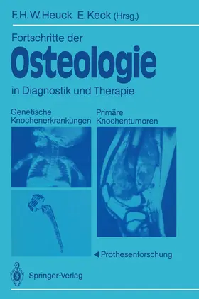 Heuck / Keck |  Fortschritte der Osteologie in Diagnostik und Therapie | Buch |  Sack Fachmedien