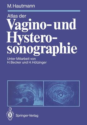 Hautmann |  Atlas der Vagino- und Hysterosonographie | Buch |  Sack Fachmedien