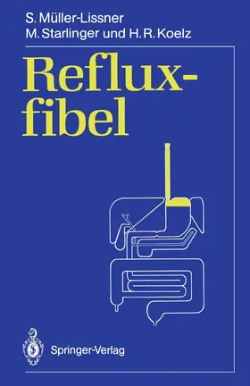 Müller-Lissner / Koelz / Starlinger | Refluxfibel | Buch | 978-3-540-51007-9 | www.sack.de