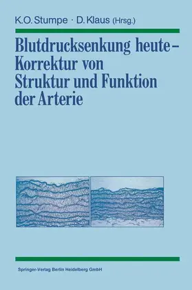 Klaus / Stumpe |  Blutdrucksenkung heute - Korrektur von Struktur und Funktion der Arterie | Buch |  Sack Fachmedien