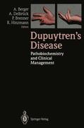Berger / Hinzmann / Delbrück |  Dupuytren¿s Disease | Buch |  Sack Fachmedien