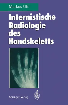 Uhl |  Internistische Radiologie des Handskeletts | Buch |  Sack Fachmedien