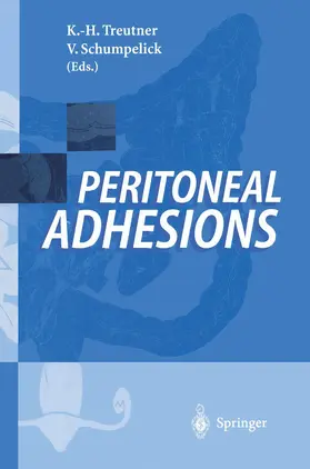 Treutner / Schumpelick |  Peritoneal Adhesions | Buch |  Sack Fachmedien