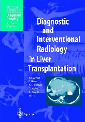 Bücheler / Nicolas / Krupski |  Diagnostic and Interventional Radiology in Liver Transplantation | Buch |  Sack Fachmedien