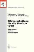 Lehmann / Tolxdorff / Metzler |  Bildverarbeitung für die Medizin 1998 | Buch |  Sack Fachmedien