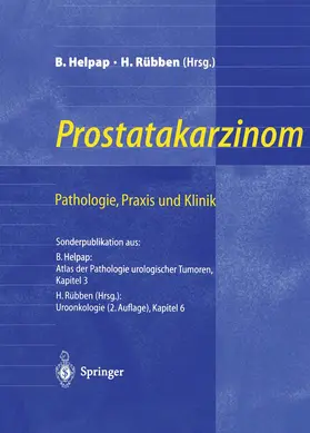 Helpap / Rübben |  Prostatakarzinom - Pathologie, Praxis und Klinik | Buch |  Sack Fachmedien