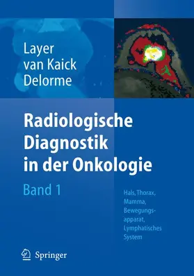 Layer / Kaick / Delorme |  Radiologische Diagnostik in der Onkologie | Buch |  Sack Fachmedien