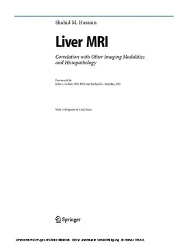 Hussain |  Liver MRI | eBook | Sack Fachmedien