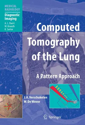 Verschakelen / de Wever | Computed Tomography of the Lung | E-Book | sack.de