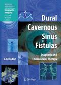 Benndorf |  Dural Cavernous Sinus Fistulas | eBook | Sack Fachmedien