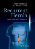 Schumpelick / Fitzgibbons |  Recurrent Hernia | eBook | Sack Fachmedien