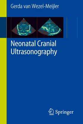 Meijler |  Neonatal Cranial Ultrasonography | eBook | Sack Fachmedien